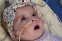 Seven-month-old Indi Gregory has mitochondrial disease (Family handout/PA)