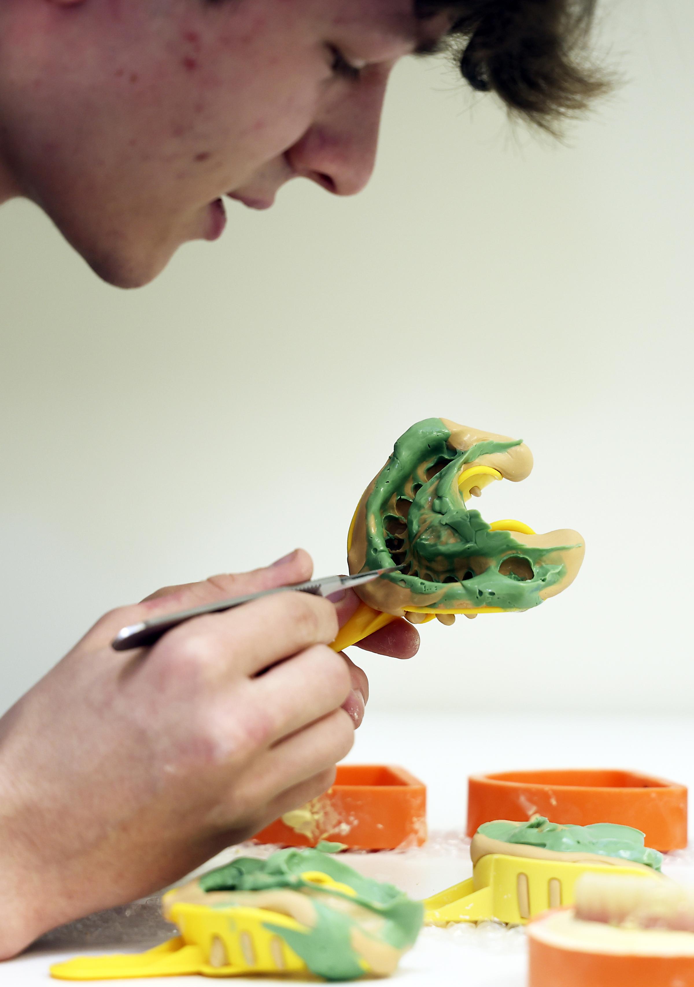 Jack Kerr, Trainee Dental Technicial, casting silicone impressions of a patents teeth.